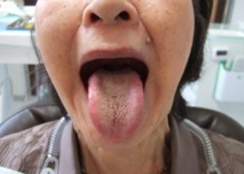 舌は自由に動かせますか？
